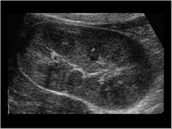 Pediatric ultrasound scan