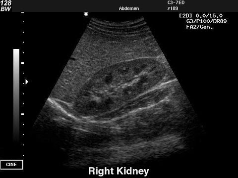 renal scan