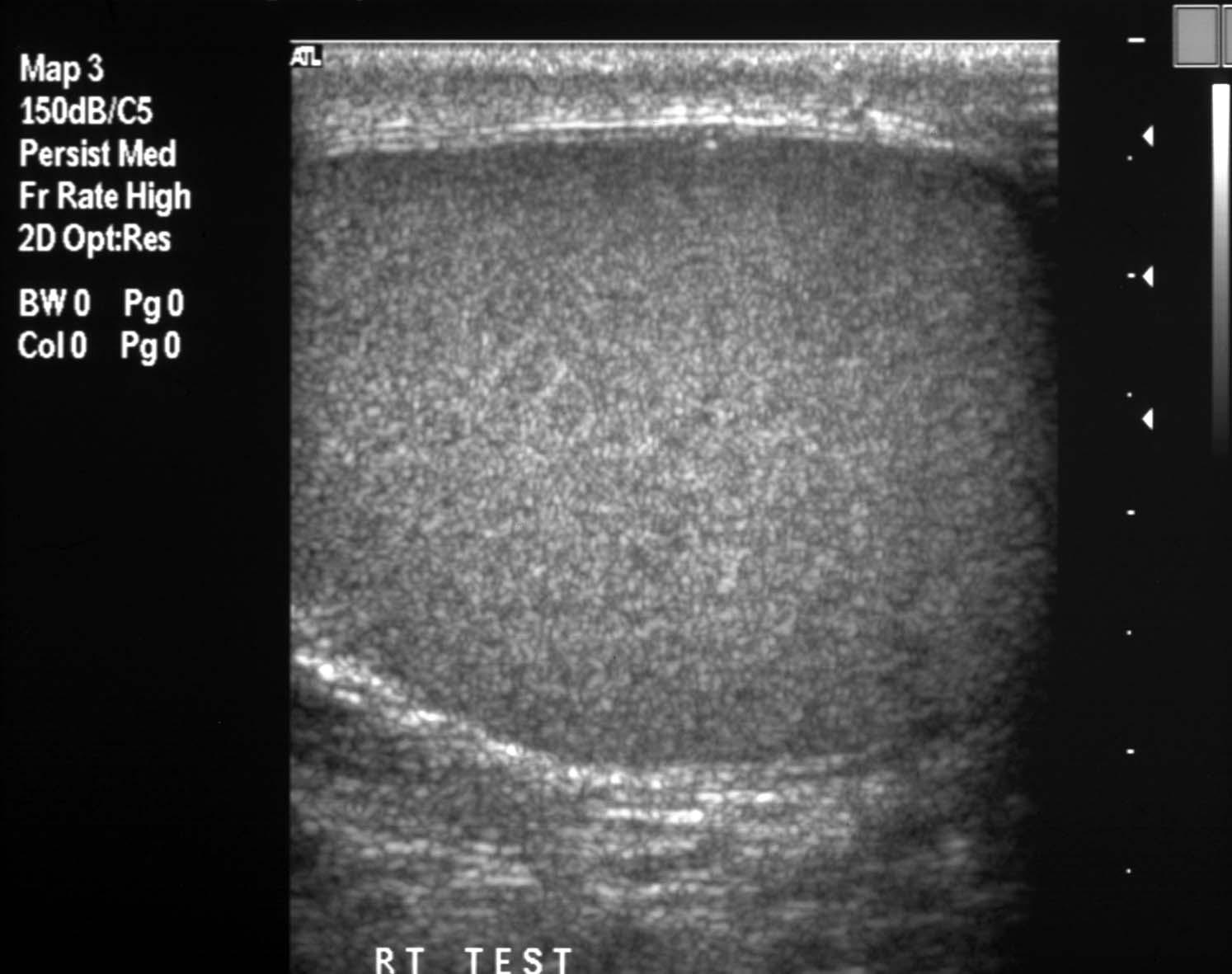 small parts ultrasound scan